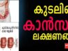 കുടലിലെ കാന്സര്: ലക്ഷണങ്ങളും ചികിത്സയും