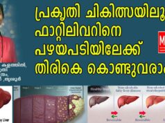 പ്രകൃതിചികിത്സയിലൂടെ ഫാറ്റിലിവറിനെ പഴയപടിയിലേക്ക് തിരികെ കൊണ്ടുവരാം: ഡോ.ജെന്നി കളത്തിൽ